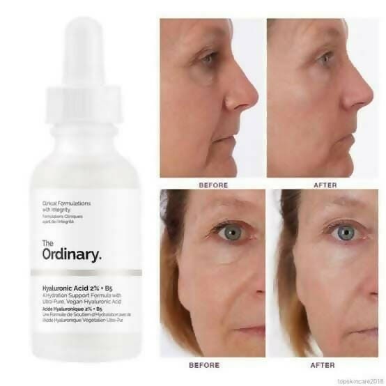 THE ORDINARY Ácido Hialurónico 2% + B5
